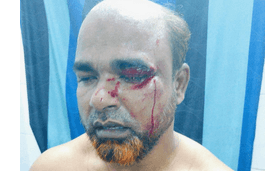 শহীদ মিনারে ফুল দিয়ে ফেরার পথে নাগরিক ঐক্যের নেতাকে ছুরিকাঘাত
