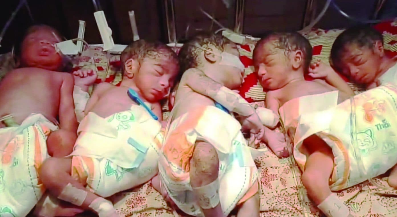চট্টগ্রামে একইসাথে ৫ নবজাতক সহোদরের জন্ম